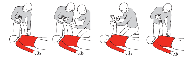 Schritt-für-Schritt-Grafik zur Blutstillung: Eine Person übt direkten Druck auf eine stark blutende Wunde am Arm einer liegenden Person aus und legt anschließend einen Druckverband an.
